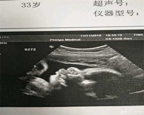 上海代孕网代生孩子公司_孕妇晚上开灯睡觉对宝宝有影响吗