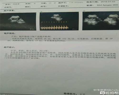 上海正规代孕包性别_产检宫颈炎中度严重吗