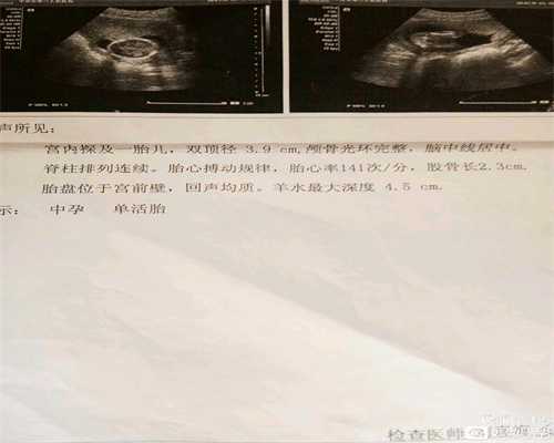 上海代怀孕网_孕妇早期都有什么症状