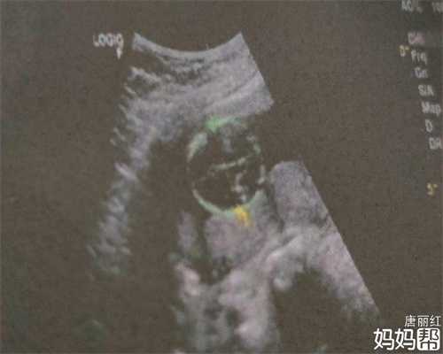 上海代孕医院的流程_8种孕妇容易生女孩