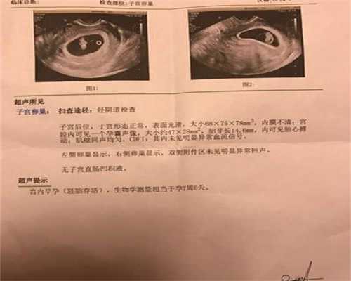 上海代孕-上海第三代试管弊端-上海代孕生孩子多少钱啊