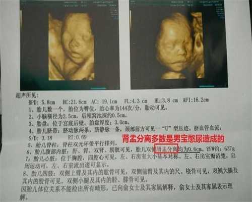 上海急寻代孕-上海孕妈妈如何收费-上海代生宝宝不孕咨询