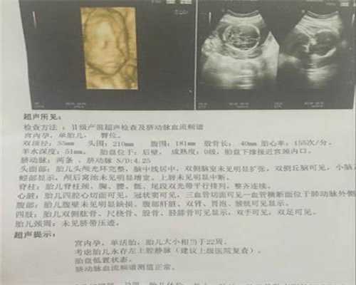 上海代孕风险_上海试管代孕哪里好_上海代孕生殖机构包生男孩
