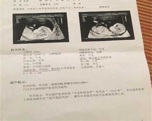 上海代孕医院，上海代怀孕上门洽谈，上海代孕机构靠不靠谱