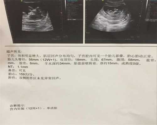 上海代孕手续,上海找代孕者,上海借卵试管费用高吗